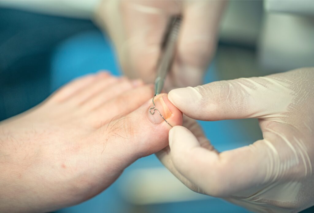 Podolog Giżycko – gdzie zadbać o stopy w mieście i okolicy